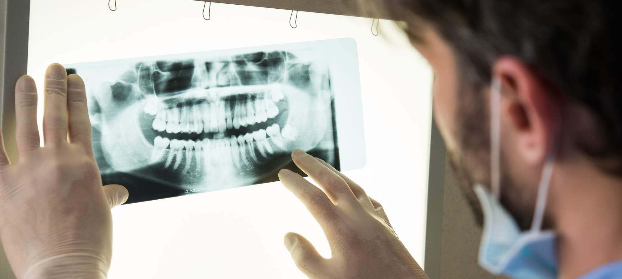 Oral Surgery Sparta NJ Oral Surgeon Vernon NJ Facial Cosmetics